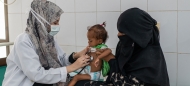 الامم المتحدة تسجل أكثر من 50 الف اصابة بالحصبة في اليمن منها 568 حالة وفاة خلال العام الجاري