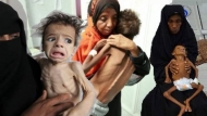 البنك الدولي.. سنوات الصراع حولت اليمن إلى أكثر البلدان فقراً في العالم