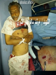 تعز.. الهدنة الميته "تقرير"