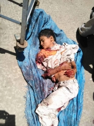 صورة لطفل قتل في غارات التحالف في اب